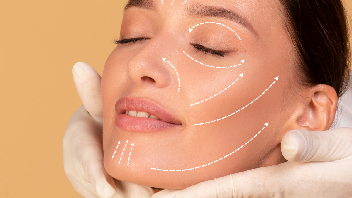 Reversão de botox