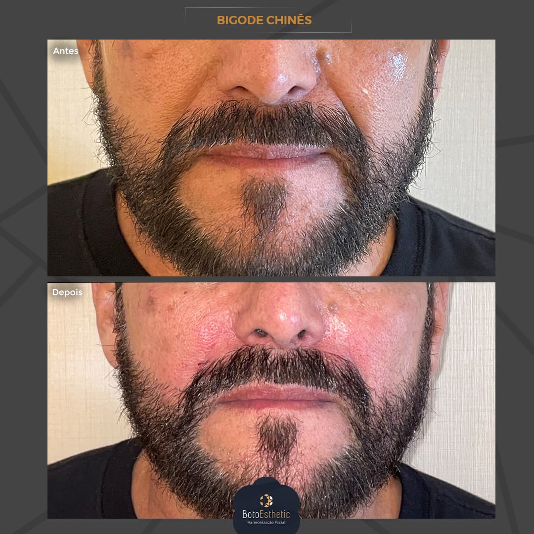 BE-Bigode-Chines-3.jpg