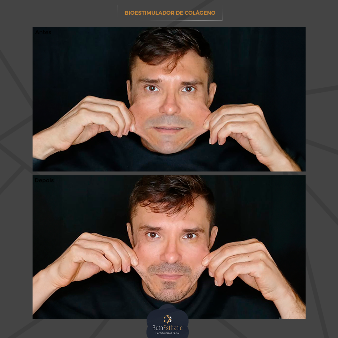 BE-Bioestimulador-2.png