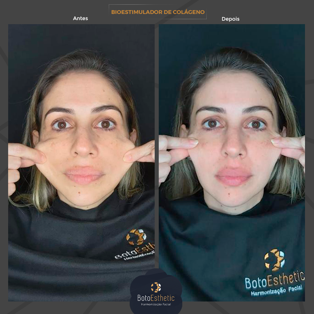 BE-Bioestimulador-3.png