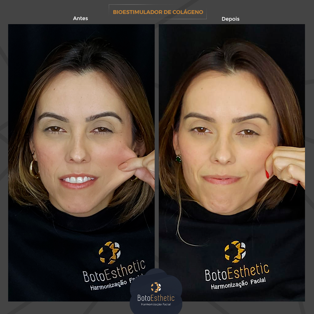 BE-Bioestimulador-4.png