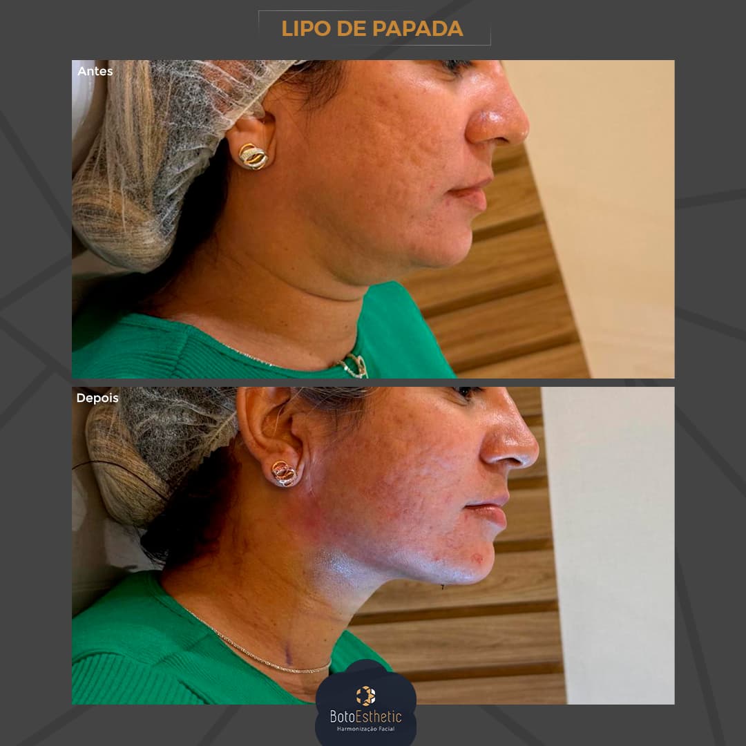 BE-Papada-8.jpg