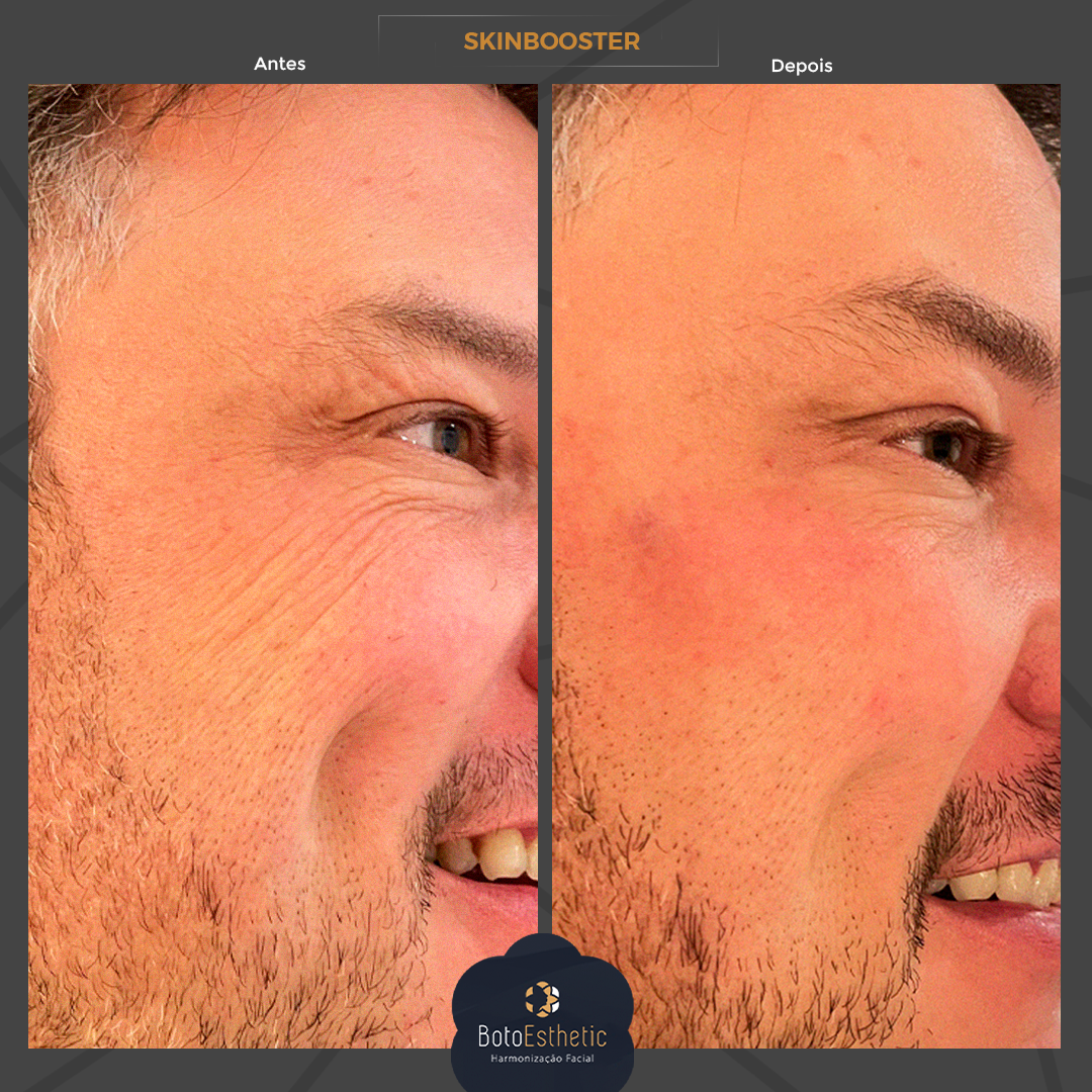 BE-Skinbooster-1.png