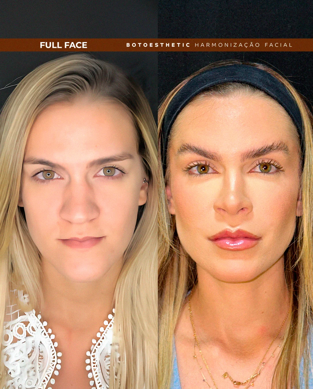FULL FACE 1