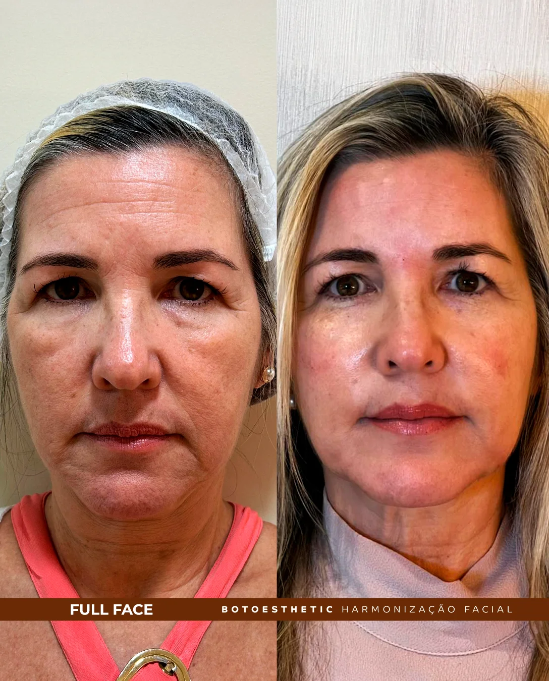 FULL FACE 2(1)